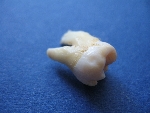vytrhnutý zub